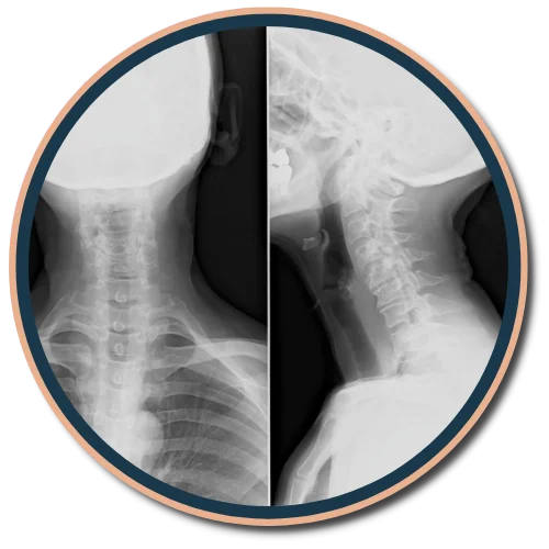 X-rays in West Palm Beach
